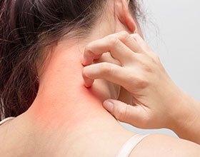Eczema treatment, Austin, TX and Round Rock, TX